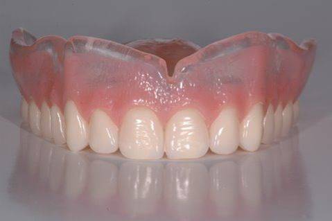Can You Sleep with Dentures? What Dentists Recommend